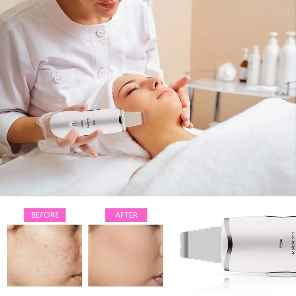 3-in-1 Ultrasonic Facial Skin Spatula